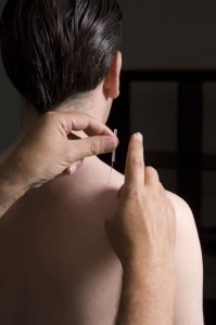 Acupuncture